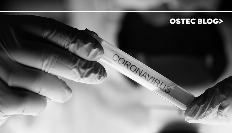 Mãos segurando tubo de ensaio com etiqueta onde se pode ler coronavirus. Testes feitos pela Organização Mundial de Saúde